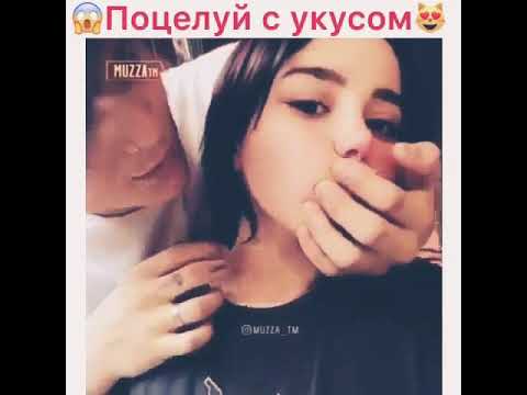 🎄Поцелуй с укусом 💞💕 !!!