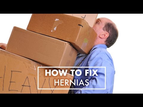 How Hernias Are