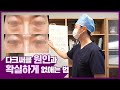 다크서클 없애고 싶으신 분~ 확실하게 없애드립니다!