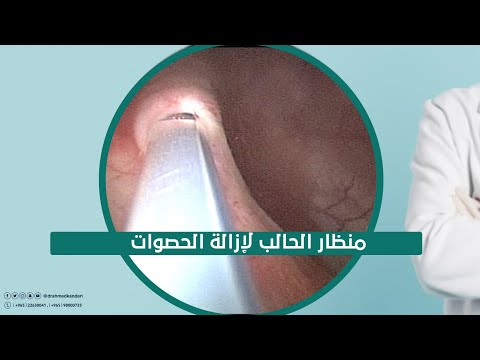 فيديو: حصوات المسالك البولية في الجرذان