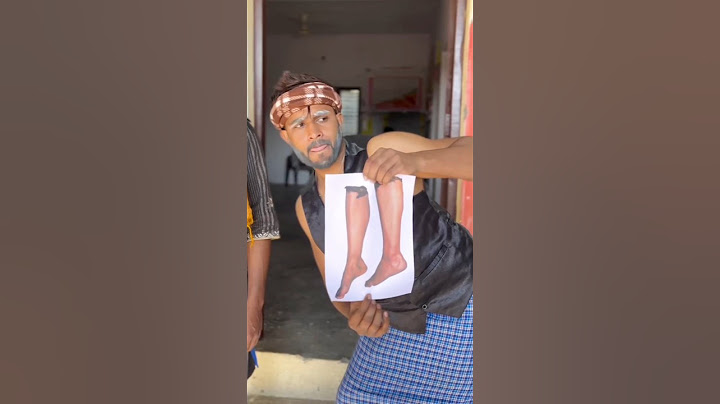 विधायक का कारनामा 🤣🤣 🤣comedy video #comedy #funny #trending #shorts