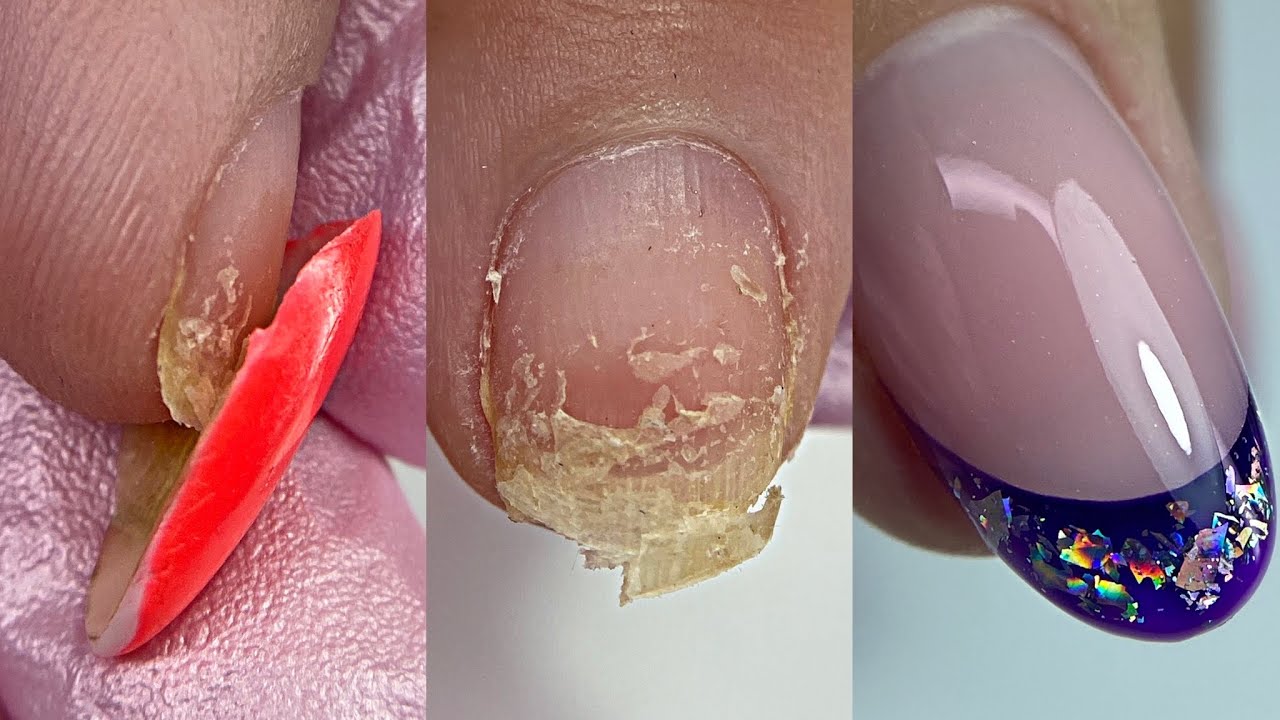 Почему гель лак отслаивается от натурального ногтя. Почему гель лак отслаивается от натурального ногтя. Отслаивается гель лак. Облезлый лак на ногтях. Отслойка покрытия гель лаком.