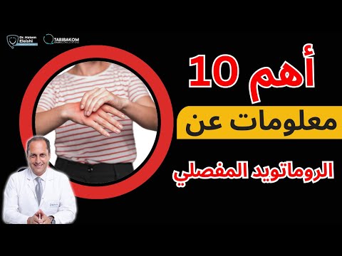 اهم عشر معلومات عن الروماتويد المفصلي أ د حاتم العيشي