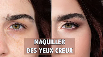 Pourquoi j'ai les yeux creux ?