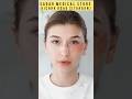 how to remove dark circles