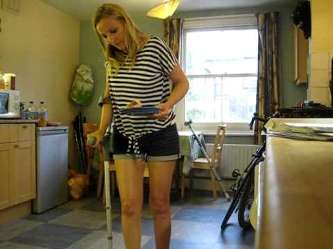Broken Tibia & Fibula - no cast - 6 weeks - Carrying my own plate