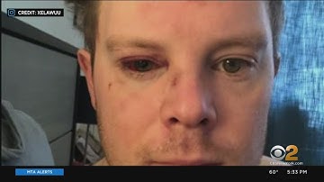 Broadway Actor Sucker-Punched While Getting Off Subway