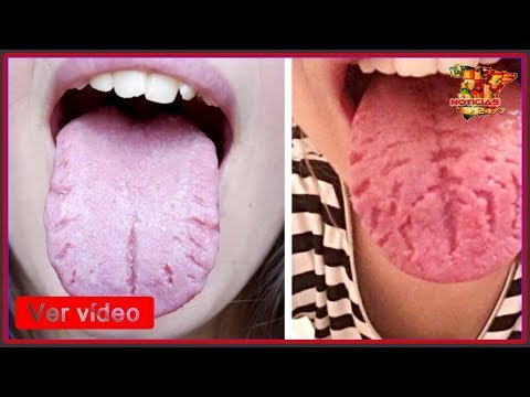 8 Causas que