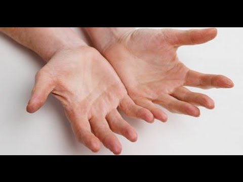 افضل عﻻج لتقشر كفوف اليد وخشونتها Youtube