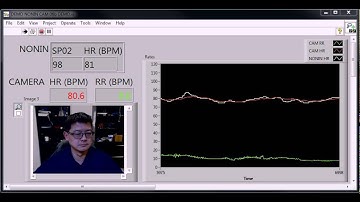 Non-Contact Heart Rate and Respiratory Rate Monitor