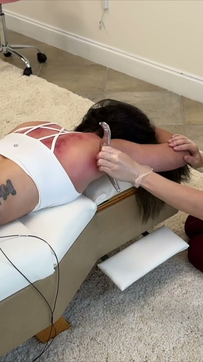 Strange Toxins Came out of Her Back 👀 CRUNCHY #chiropractic #guasha #asmr #shorts