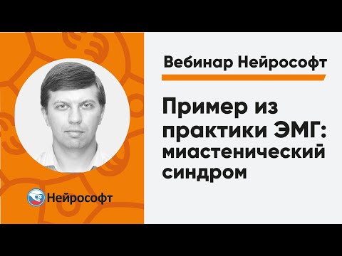 Пример из практики ЭМГ: миастенический синдром | Вебинар Нейрософт