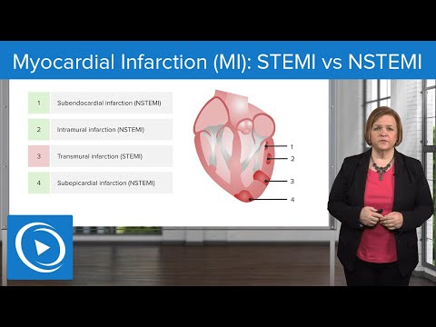 Video: Kaip gydyti Nstemi (su nuotraukomis)