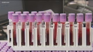 UCSD doctor talks about a new cure for HIV