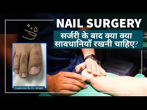 Nail in the Coffin Meaning in Hindi | Nail in the Coffin ka matlab kya hota  hai | idioms explained - YouTube