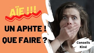 😛 7 astuces pour soigner un aphte naturellement