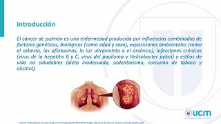 Cuidados de Enfermería en Cáncer Pulmonar