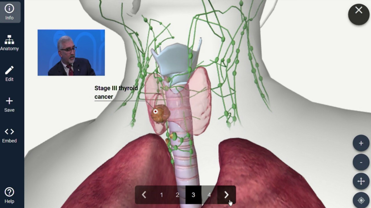 The Thyroid Cancer YouTube