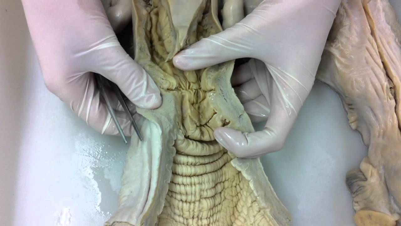 anatomia practica 1 aparato reproductor femenino par3 - YouTube