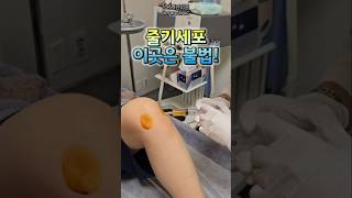 아무대서나 받지말자 #줄기세포 #줄기세포주사 #줄기세포두피 #줄기세포치료무릎 #줄기세포피부시술 #무릎통증 #피부 #탈모 #항노화 #면역력 #안티에이징