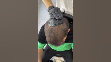 Batçı concealer continues to bring happiness to people with its unique formula. #batci  #hair