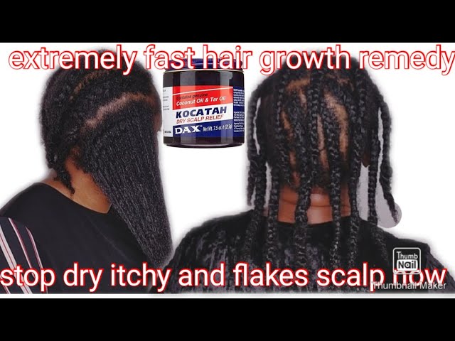 All About Kocatah the Black Dax Grease. 4C natural hair. 