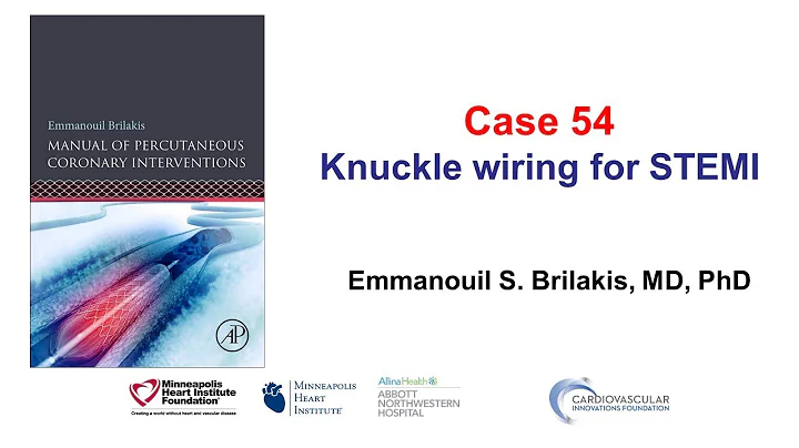 Case 54: PCI Manual - Knuckle wiring for STEMI