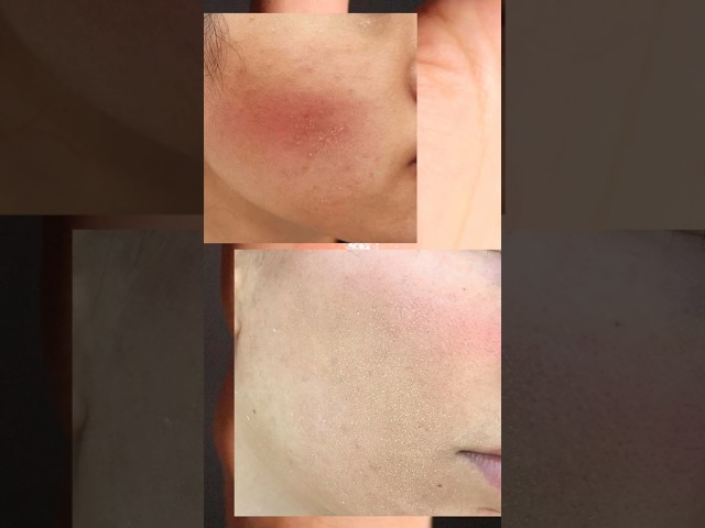 リキッドチークが汚くなる、粉浮する人必見👀✨艶々仕上がりにするテクニック♡ #さゆりメイク#チーク#クリームチーク