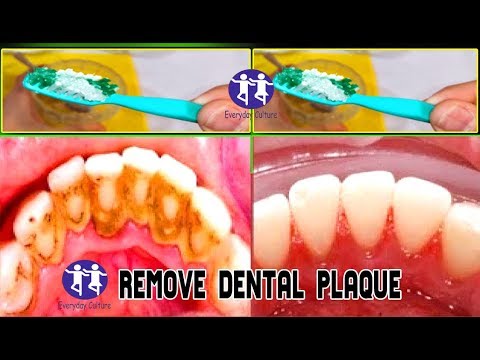 My Grandmother Told Me a Secret, remove Dental Plaque 4 minutes without going to the Dentist!