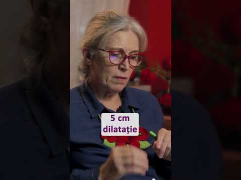 Durerea la nașterea