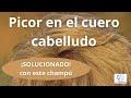 Cómo hacer un CHAMPÚ para CALMAR los PICORES del CUERO CABELLUDO/Cosmética NATURAL CASERA/ Alquímica