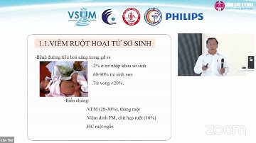 [CME 2022] 07 Hình ảnh siêu âm bụng ngoại khoa ở trẻ em - BS.CK2. Nguyễn Hữu Chí