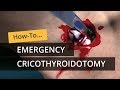 Emergency cricothyroidotomy using crickey