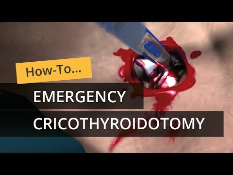 Emergency Cricothyroidotomy using CricKey