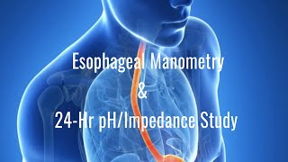 High-Resolution Manometry & 24-hr pH Study