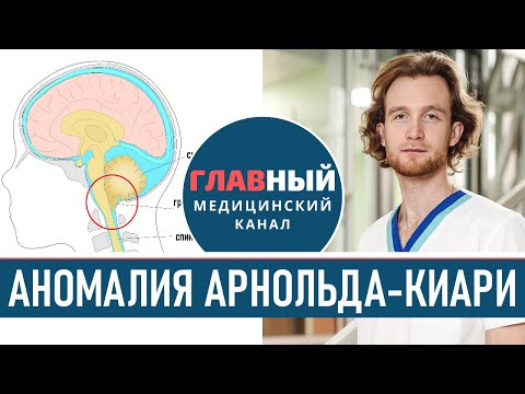 Видео: Как измерить эктопию миндалин мозжечка?