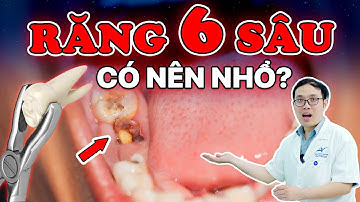 Răng Số 6 Bị Sâu Có Nên Nhổ Không? 6 Trường Hợp Không Thể Cứu, Bắt Buộc Phải Nhổ!