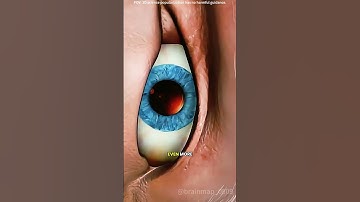 How photorefractive keratectomy procedure is done?(3D animation) #drone #theflash #space #automobile