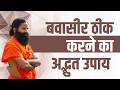 बवासीर (Piles) ठीक करने का अद्भुत उपाय || Swami Ramdev