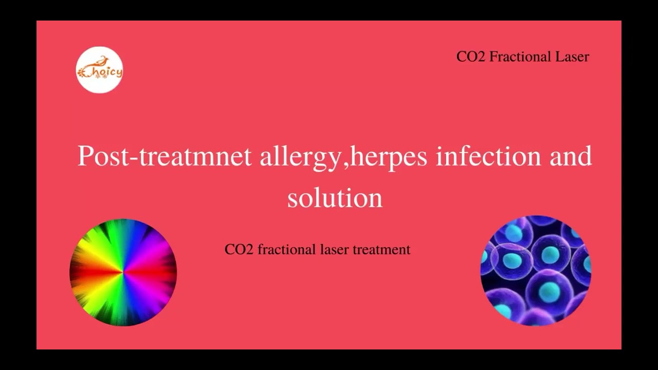 allergy after co2 fractional laser treatment how to solve the skin