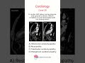 Cardiology - Case 28