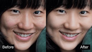 Fast Skin Retouching: remove redness & smooth skin with SkinFiner screenshot 2
