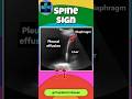 #spine #sign #ultrasound #artefact