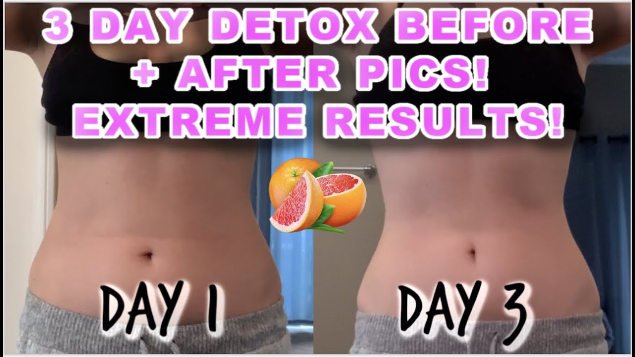 Extremely Fast Weight Loss! 3 Day Detox! I Lost 9 Inches & 5.5Lbs Vlog  Before & After Results 😱 - Youtube