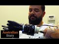 Robotics change man's life after losing both arms in horrific workplace accident | Australian Story