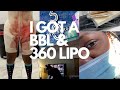 BBL VLOG *GRAPHIC* FULL WEEK RECOVERY | 305 Plastic Surgery/ Mia Luxury Stay