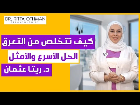 كيفية علاج فرط التعرق و التعرق الزائد ✅ الحل الأسرع للتعرق تحت الابط واليدين