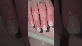 Crecimientos Mas De 1 Mes De Kapping Capping Gel Ñas