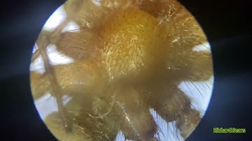 UNDER THE MICROSCOPE:,Black Widow/possible Brown Recluse! 11/21/22.