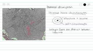 Fibrocartilage (Fibrous cartilage) Connective Tissue